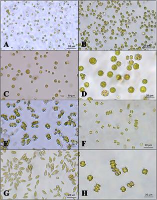 Machine learning for microalgae detection and utilization